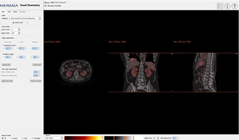 Voxel Dosimetry（線量分布計算）